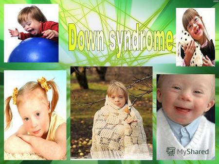 What is Down syndrome? Some people who have problems with development have Down Syndrome. Dr John Langdon Down is the first person to have identified.