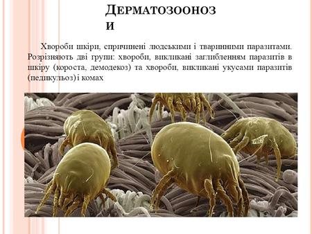 Д ЕРМАТОЗООНОЗ И Хвороби шкіри, спричинені людськими і тваринними паразитами. Розрізняють дві групи: хвороби, викликані заглибленням паразитів в шкіру.